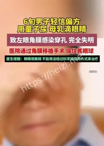 童子尿滴眼危害