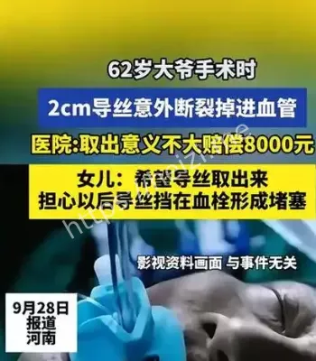 手术导丝遗留事件